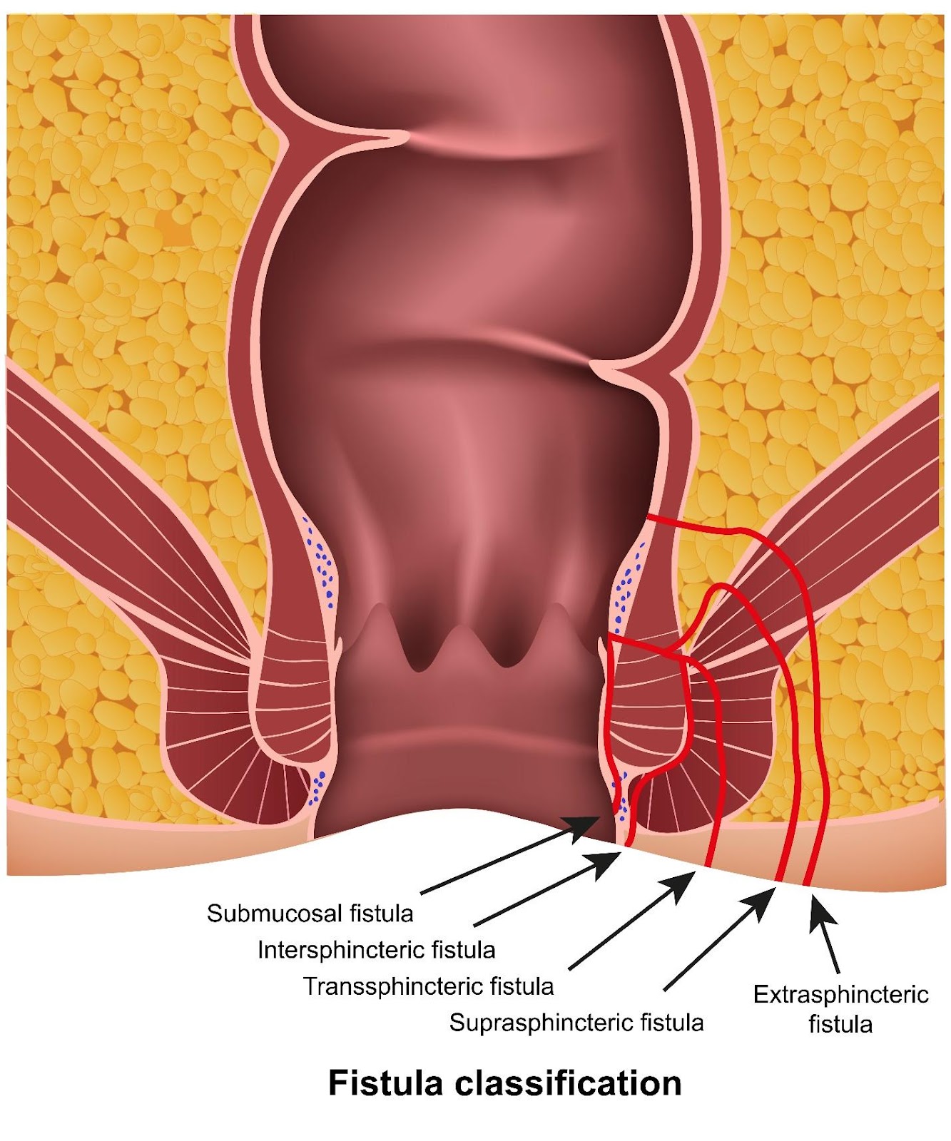 A diagram of the uterus

AI-generated content may be incorrect.