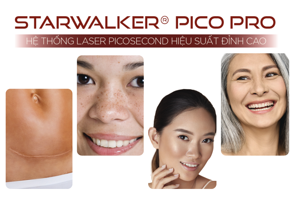 Ứng Dụng Đa Dạng Của StarWalker Pico Pro Trong Điều Trị Thẩm Mỹ