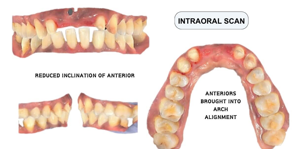 dental oral scan