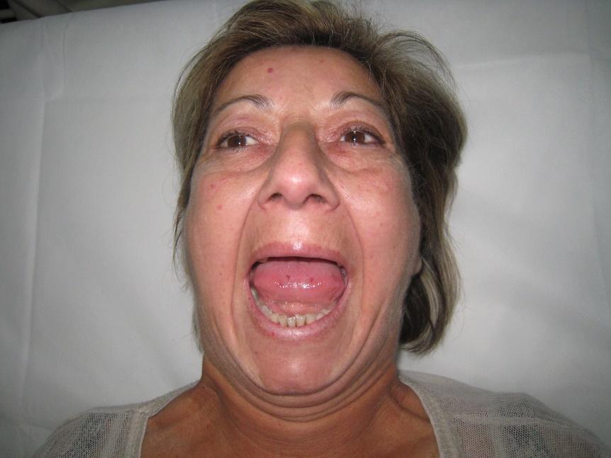 A person with the mouth open

Description automatically generated with medium confidence