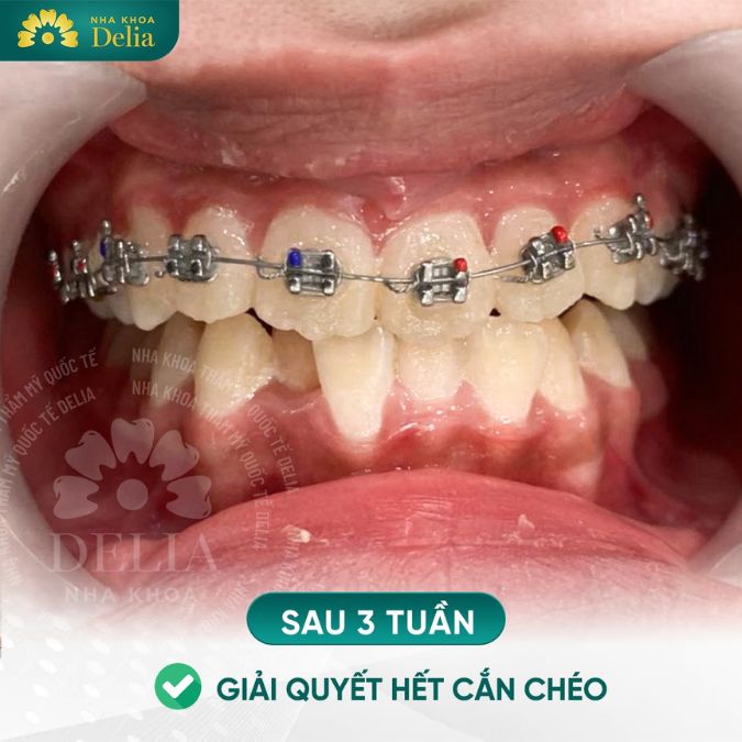 Delia tự hào mang đến những giải pháp toàn diện cho các vấn đề về răng miệng