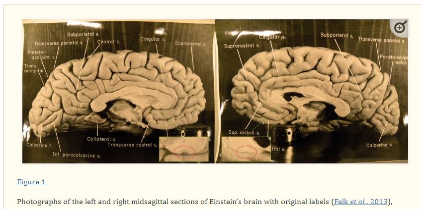 A close-up of a brain

Description automatically generated