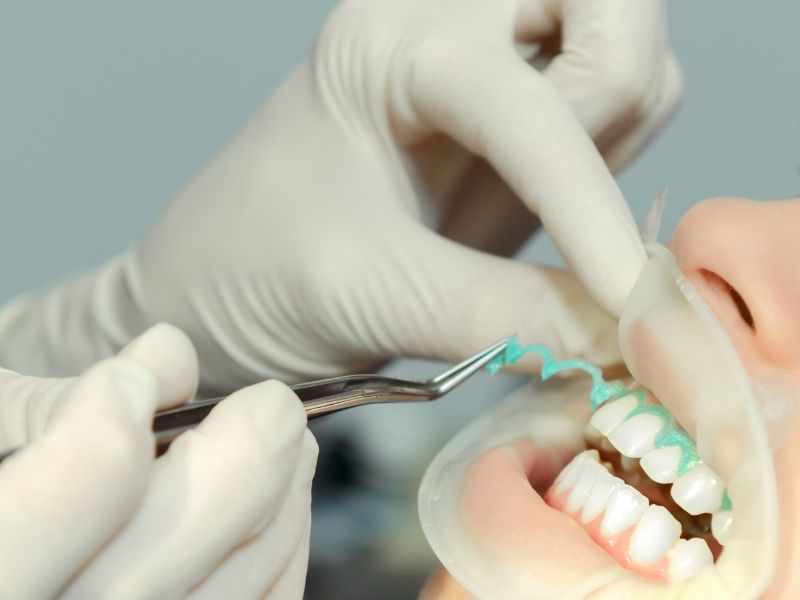 quanto custa clareamento dental sessões