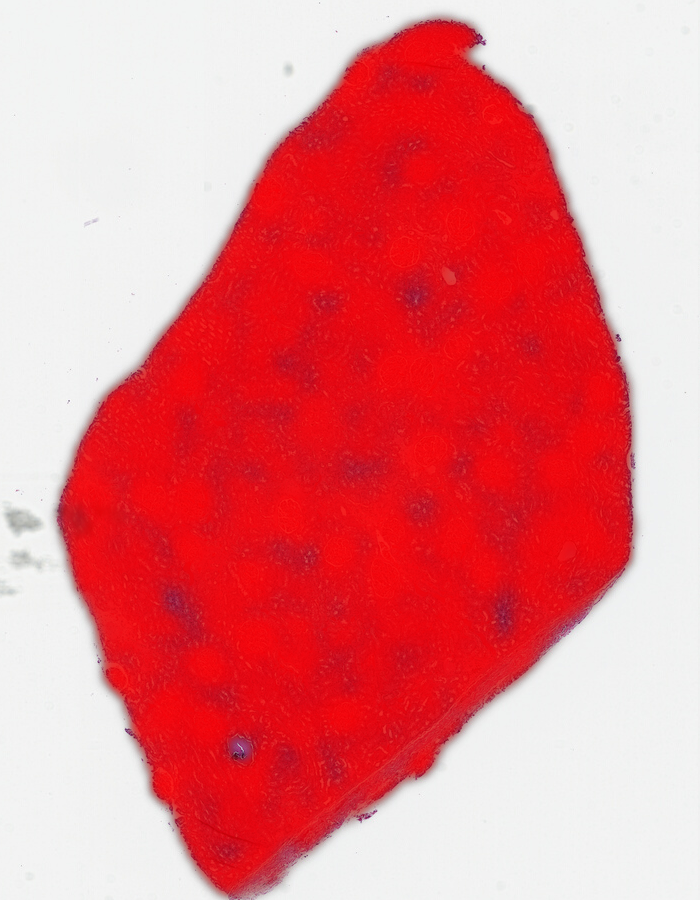 The sample renal tissue with almost all of the tissue "found" by the DinoV2 model