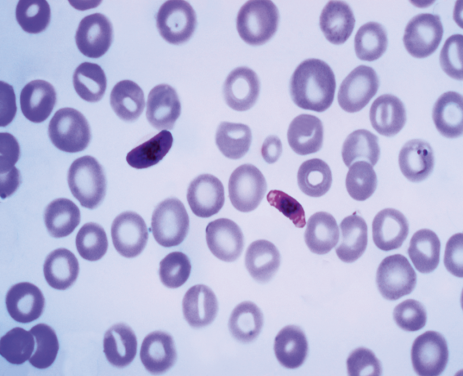 Plasmodium falciparum