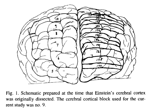 A diagram of a brain

Description automatically generated