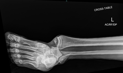 X-ray of a hand

Description automatically generated