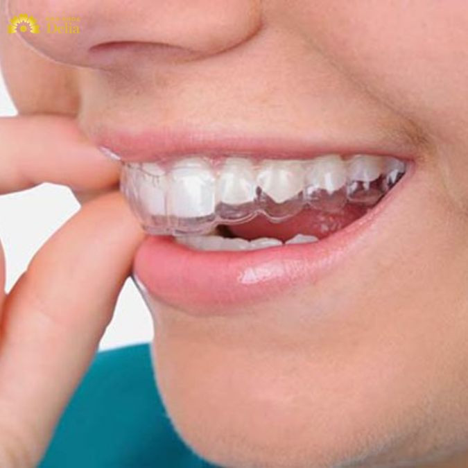 Invisalign được đánh giá là có chất lượng cao và hiệu quả điều trị tốt nhất