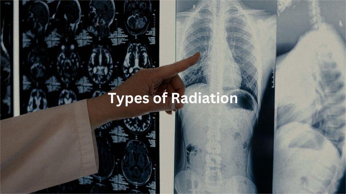 radiation concerns