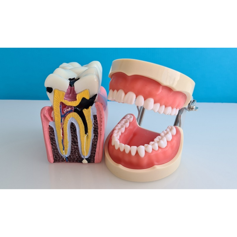 Top 8 Root Canal Treatment Side Effects Explained