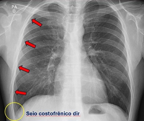 Uma imagem contendo chapa, olhando, perto, homem

Descrição gerada automaticamente