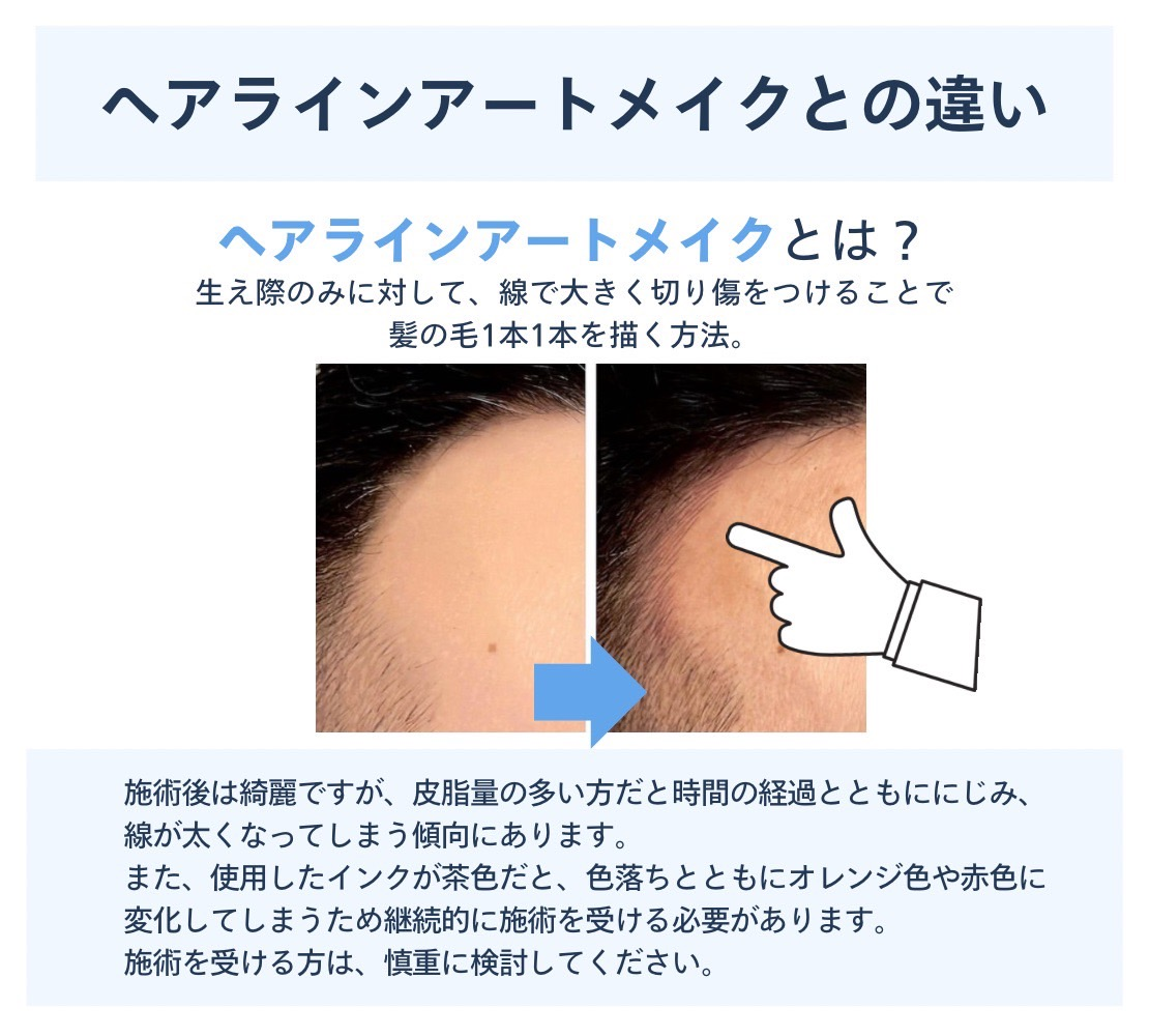 ヘアラインメークとは