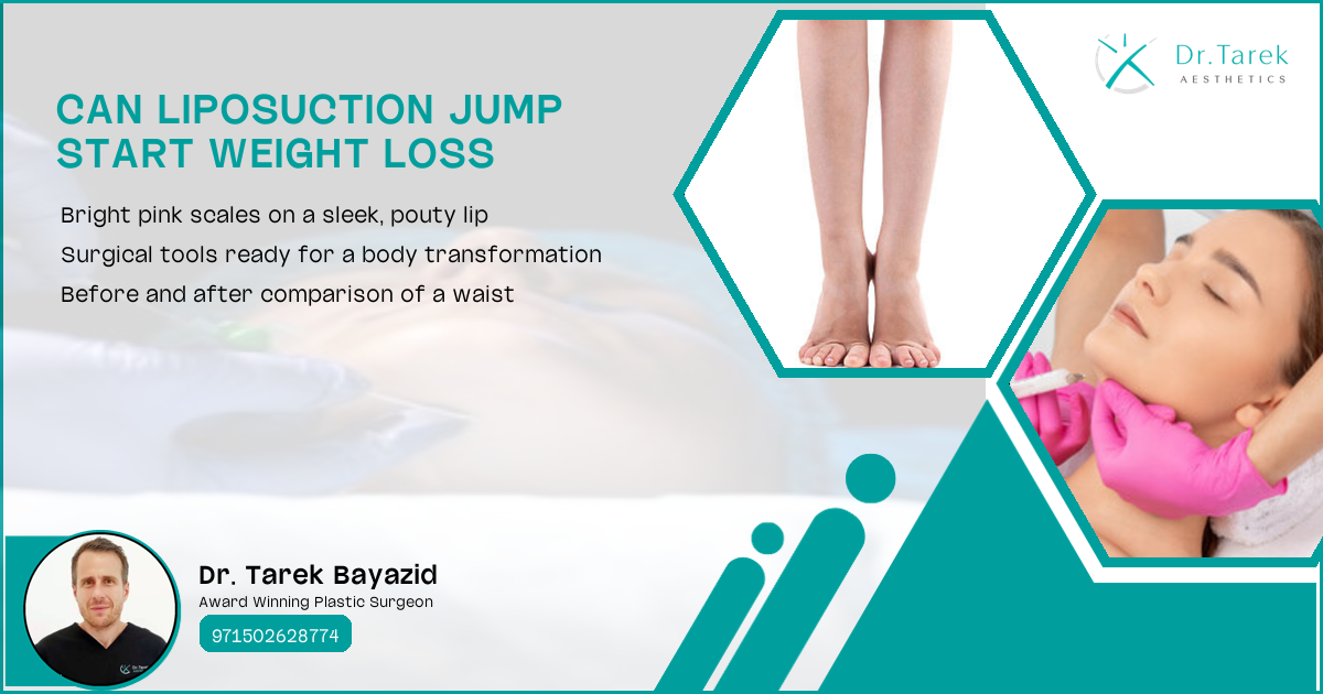 Can Liposuction Jump Start Weight Loss