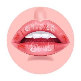 Chapped Lips Stock Illustrations – 52 Chapped Lips Stock Illustrations,  Vectors & Clipart - Dreamstime