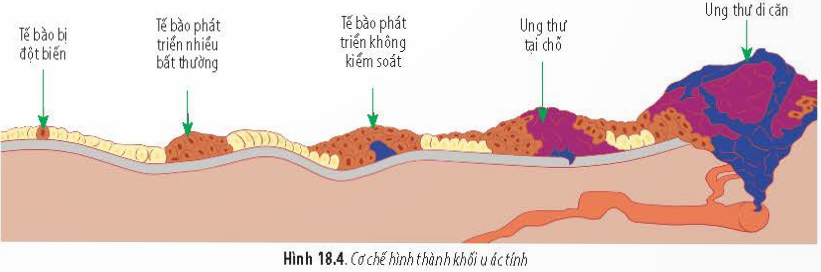 BÀI 18 - CHU KÌ TẾ BÀOMỞ ĐẦUCâu 1: Chu kì tế bào là hoạt động sống rất quan trọng đối với cơ thể sinh vật. Vậy cơ chế nào kiểm soát chu kì tế bào? Nếu sự phân chia tế bào một cách không bình thường sẽ dẫn đến hậu quả gì?Đáp án chuẩn:Chu kỳ tế bào kiểm soát sự phân bào qua các điểm kiểm soát. Nếu phân chia tế bào không bình thường, có thể gây ung thư, do các tế bào lỗi liên tục được tạo ra, tạo thành khối u và có thể di căn đến các cơ quan khác.I. KHÁI NIỆM CHU KÌ TẾ BÀOCâu 1: Chu kì tế bào là gì? Đáp án chuẩn:Chu kỳ tế bào là quá trình từ lần phân bào này đến lần phân bào tiếp theo, trong đó các sự kiện diễn ra tuần tự dẫn tới hình thành hai tế bào con từ một tế bào mẹ ban đầu.Câu 2: Sau một chu kì tế bào thì từ một tế bào mẹ ban đầu tạo ra được bao nhiêu tế bào con? Đáp án chuẩn:- Hai tế bào con.Luyện tập: Các tế bào mới được tạo ra từ tế bào ban đầu giống hay khác nhau?Đáp án chuẩn:- Giống nhau và giống với tế bào mẹ ban đầu.II. CÁC PHA CỦA CHU KÌ TẾ BÀOCâu 3: Hãy quan sát Hình 18.1 và cho biết: Chu kì tế bào gồm những giai đoạn nào? Kể tên các giai đoạn của chu kì tế bào.Đáp án chuẩn:Chu kì tế bào gồm 2 giai đoạn: Kỳ trung gianGia đoạn phân chia tế bào (Pha M)Câu 4: Hãy quan sát Hình 18.1 và cho biết: Trình bày mối quan hệ giữa các pha trong chu kì tế bào.Đáp án chuẩn:Mối quan hệ giữa các pha trong chu kì tế bào: Giai đoạn chuẩn bị giúp tổng hợp các chất cần thiết cho giai đoạn phân chia và kiểm soát chu kì tế bào.  Pha phân bào tạo ra các tế bào mới, các tế bào này tiếp tục quá trình phân bào.Luyện tập: Lập bảng trình bày vai trò của các pha G1, S, G2, M xảy ra trong chu kì tế bào.Đáp án chuẩn:Các phaVai tròG1Tổng hợp các chất cần thiết chuẩn bị cho nhân đôi DNA.SNhân đôi DNA và nhiễm sắc thể.G2Tổng hợp các chất còn lại cần thiết cho sự phân bào.MQuá trình phân chia nhân để phân chia đồng đều vật chất di truyền cho các tế bào con.Quá trình phân chia tế bào chất để tách tế bào mẹ thành hai tế bào con hoàn toàn độc lập.III. KIỂM SOÁT CHU KÌ TẾ BÀOCâu 5: Hãy quan sát Hình 18.2 và cho biết: Chu kì tế bào có mấy điểm kiểm soát? Kể tên các điểm kiểm soát chu kì tế bào.Đáp án chuẩn:Có ba điểm kiểm soát chính trong chu kỳ tế bào là điểm kiểm soát G1, G2/M và chuyển tiếp giữa kỳ.Câu 6: Hãy quan sát Hình 18.2 và cho biết: Nêu ý nghĩa của việc kiểm soát chu kì tế bào.Đáp án chuẩn:Kiểm soát tế bào đảm bảo từng giai đoạn trong chu kỳ tế bào được hoàn tất chính xác trước khi tiếp tục sang giai đoạn tiếp theo. Nếu phát hiện sai sót, chu kỳ tế bào sẽ bị chặn tại điểm kiểm soát cho đến khi sai sót được khắc phục.IV. UNG THƯCâu 7: Hãy quan sát Hình 18.3 và cho biết điểm khác biệt của việc phân chia tế bào bình thường và tế bào ung thư.Đáp án chuẩn:Trong tế bào bình thường, khi phân chia tạo ra tế bào lỗi, sự kiểm soát chu kỳ tế bào phát hiện và tế bào lỗi chết theo chương trình. Trong tế bào ung thư, tế bào lỗi không chết theo chương trình mà tiếp tục phân chia, tạo ra nhiều tế bào lỗi khác.Câu 8: Hãy quan sát hình 18.4 và cho biết cơ chế hình thành khối u ác tính.Đáp án chuẩn:Khi tế bào bị đột biến, chúng có thể phân chia và tạo thành nhiều tế bào đột biến khác. Những tế bào này mất kiểm soát, dẫn đến hình thành khối u ung thư. Nếu không phát hiện và can thiệp kịp thời, khối u có thể lan qua hệ tuần hoàn hoặc hệ bạch huyết, gây ra ung thư di căn đến các cơ quan khác trong cơ thể.Luyện tập: Thông qua các biểu đồ của Hình 18.5, hãy cho biết yếu tố nào dưới đây có nguy cơ cao gây ung thư và cách phòng tránh bệnh ung thư.Đáp án chuẩn:* Yếu tố có nguy cơ cao gây ung thư: Ăn uống không lành mạnh, hút thuốc, di truyền.* Để phòng tránh ung thư, cần tuân thủ các nguyên tắc sau:- Xây dựng lối sống khoẻ như không hút thuốc, thường xuyên tập thể dục.- Có chế độ ăn uống lành mạnh và khoa học như hạn chế các thức uống có cồn và thực phẩm nhanh, ít dầu mỡ.Vận dụng: 1. Hãy tiến hành điều tra thực trạng các bệnh ung thư tại địa phương em. 2. Thiết kế áp phích hoặc vẽ tranh tuyên truyền về việc phòng chống các bệnh ung thư.Đáp án chuẩn:1. Việt Nam ghi nhận 182.563 ca mắc mới và 122.690 ca tử vong do ung thư năm 2020 theo GLOBOCAN. Tỷ lệ mắc mới là 159 trên 100.000 người và tỷ lệ tử vong là 106 trên 100.000 người. Việt Nam xếp thứ 91/185 về tỷ lệ mắc mới và thứ 50/185 về tỷ lệ tử vong. Các ung thư phổ biến ở nam giới là gan, phổi, dạ dày, đại trực tràng, tiền liệt tuyến, chiếm 65,8% tổng số ca. Ở nữ giới là vú, phổi, đại trực tràng, dạ dày, gan, chiếm 59,4% tổng số ca. Cả hai giới đều có ung thư gan, phổi, vú, dạ dày và đại trực tràng là các loại phổ biến nhất.2. BÀI TẬP