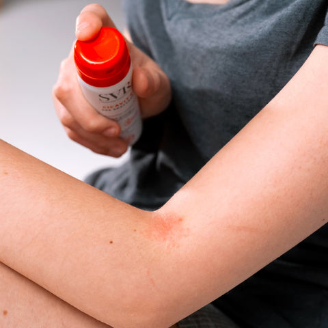 Consejos para aliviar la piel irritada
