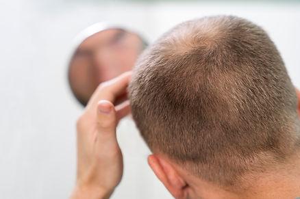 A man his looking his scalp in mirror.