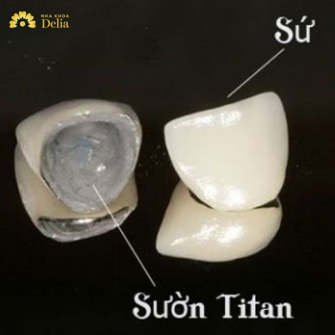 Ưu điểm của bọc răng sứ Titan