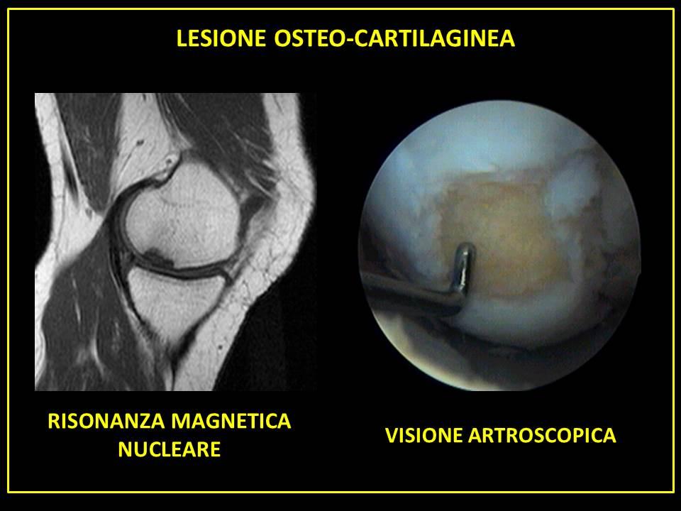 Immagine che contiene luna, arte, astronomia

Descrizione generata automaticamente