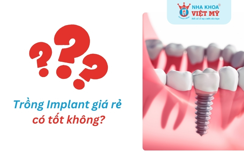 Trồng răng implant giá rẻ có tốt không