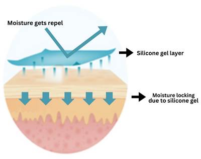 Diagram of a skin layer
Description automatically generated