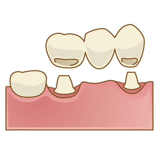 https://www.dental-sozai.com/illust/c/crown014.png