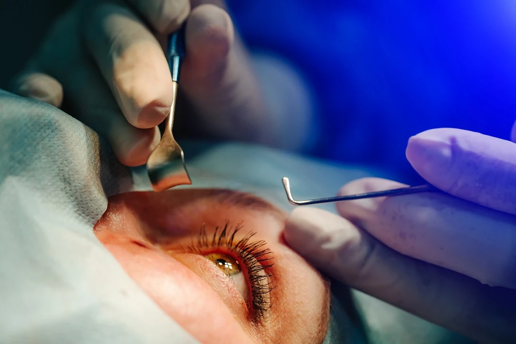 The Benefits of Cataract Surgery: Restoring Vision and Quality of Life