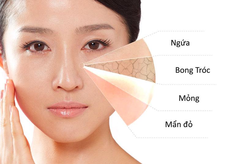 Cách nhận biết làn da nhạy cảm
