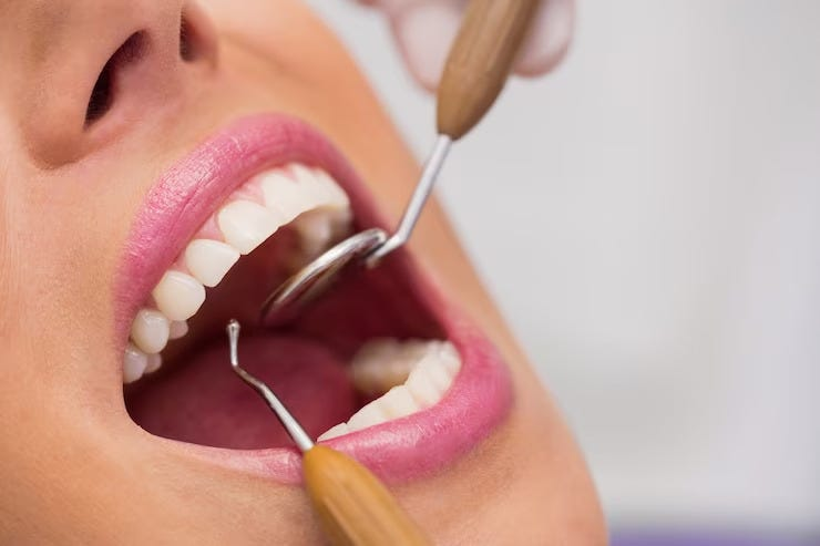 6 Incredible Benefits of Cosmetic Dentistry You Should Know