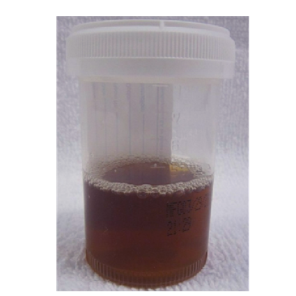 Homogentisic acid oxidase