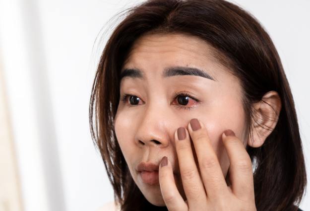 Symptoms of Pink Eye