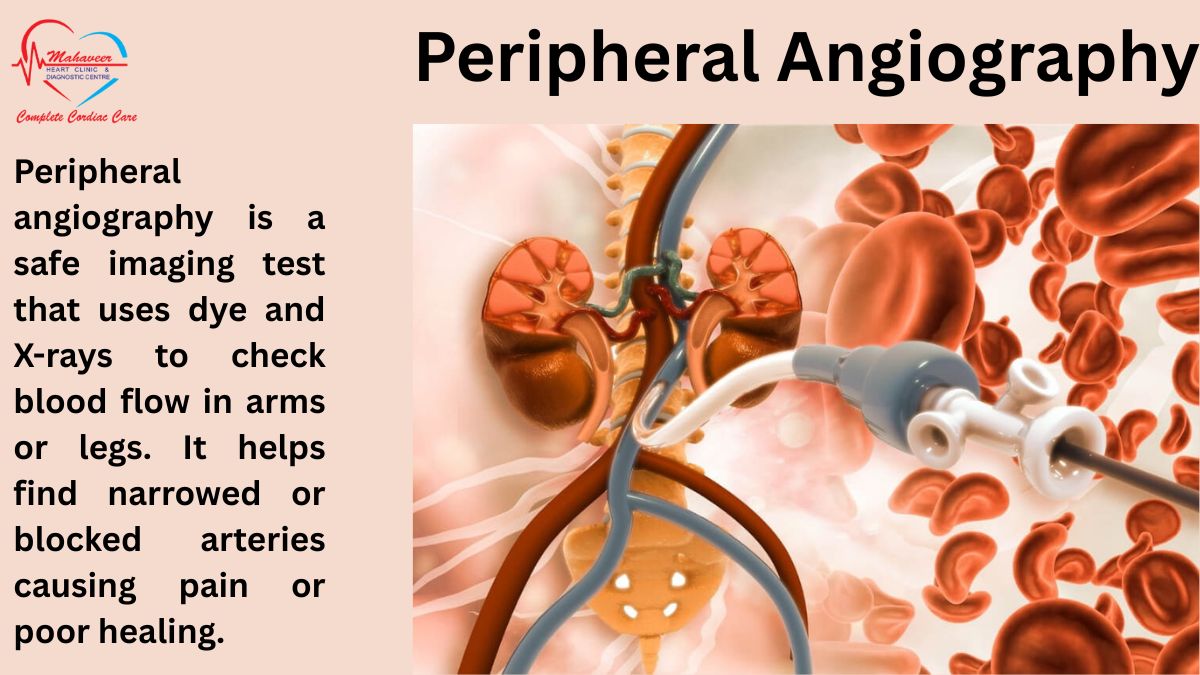Peripheral-Angiogram-Procedures by Dr Rakesh Jain - Best cardiologist