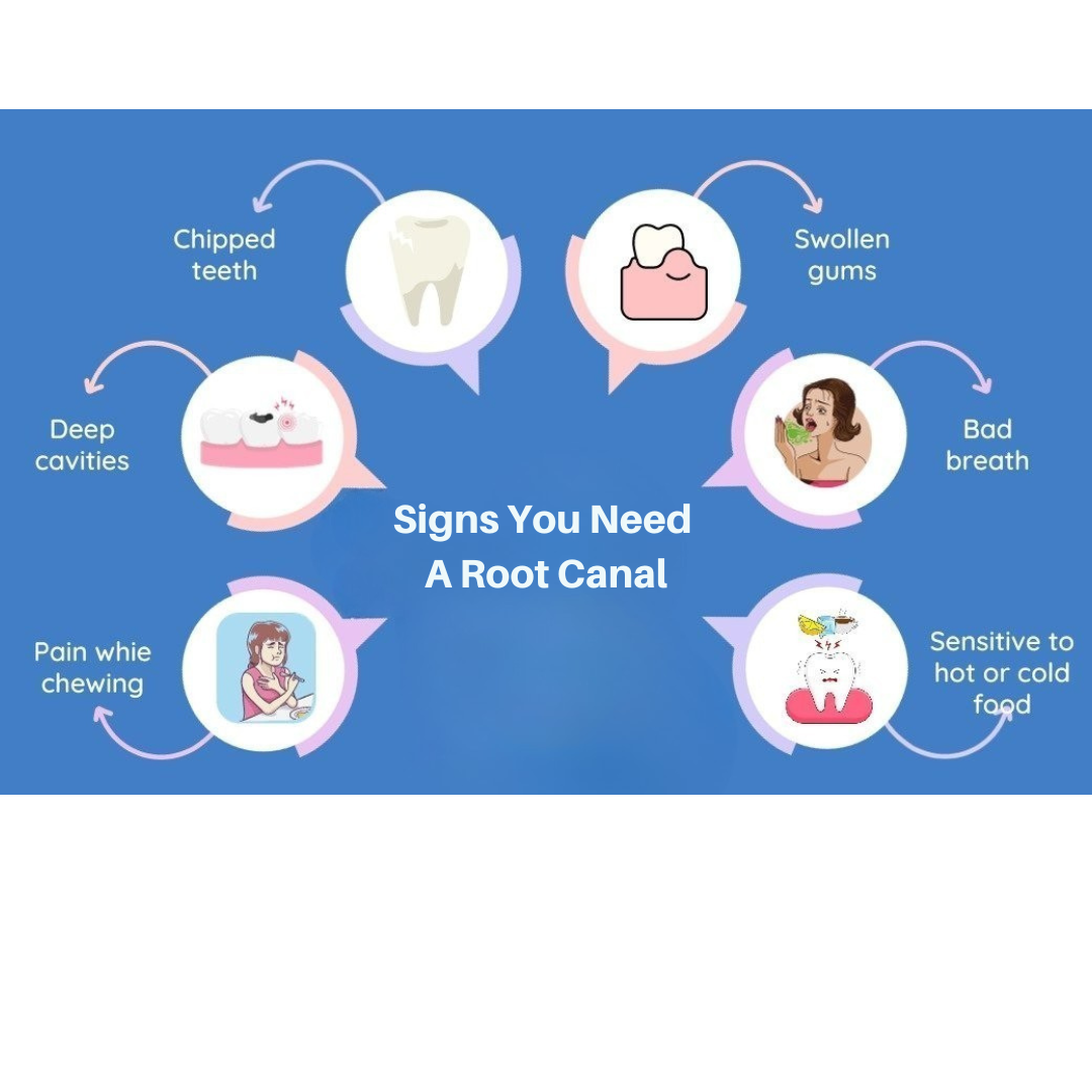 6 Signs You Need a Root Canal and What to Do Next