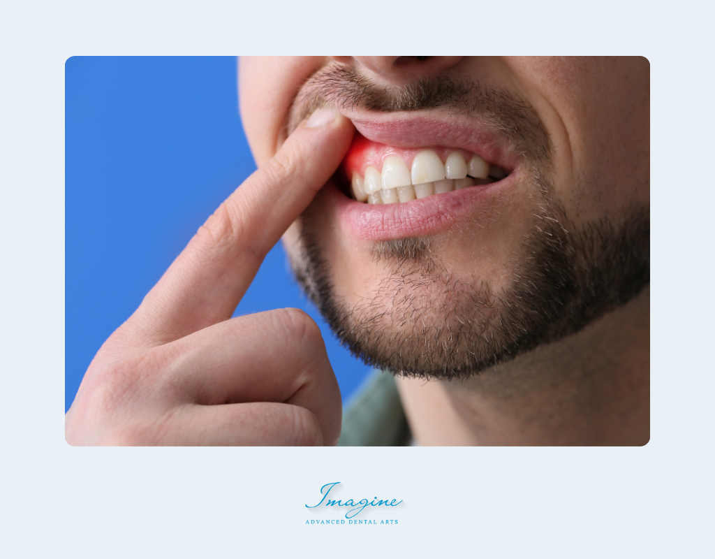 Is Periodontal Disease Hereditary?