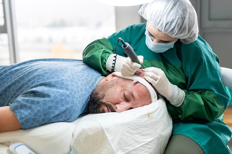 Hair Transplant Cost in India