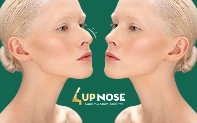 A person looking at another person's nose

Description automatically generated