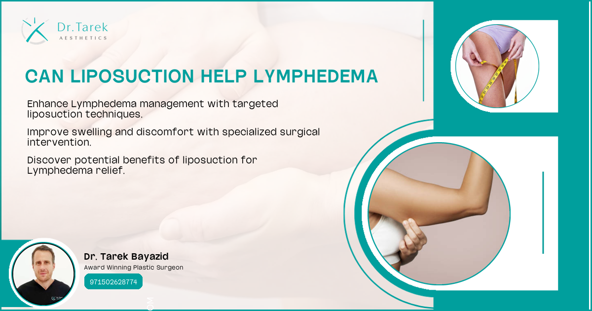 What Is Lipo Lymphedema