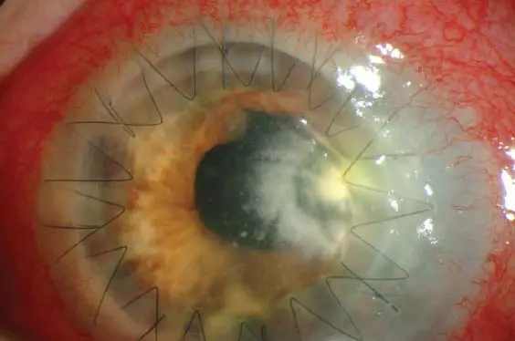 A close-up of an eyeball

Description automatically generated