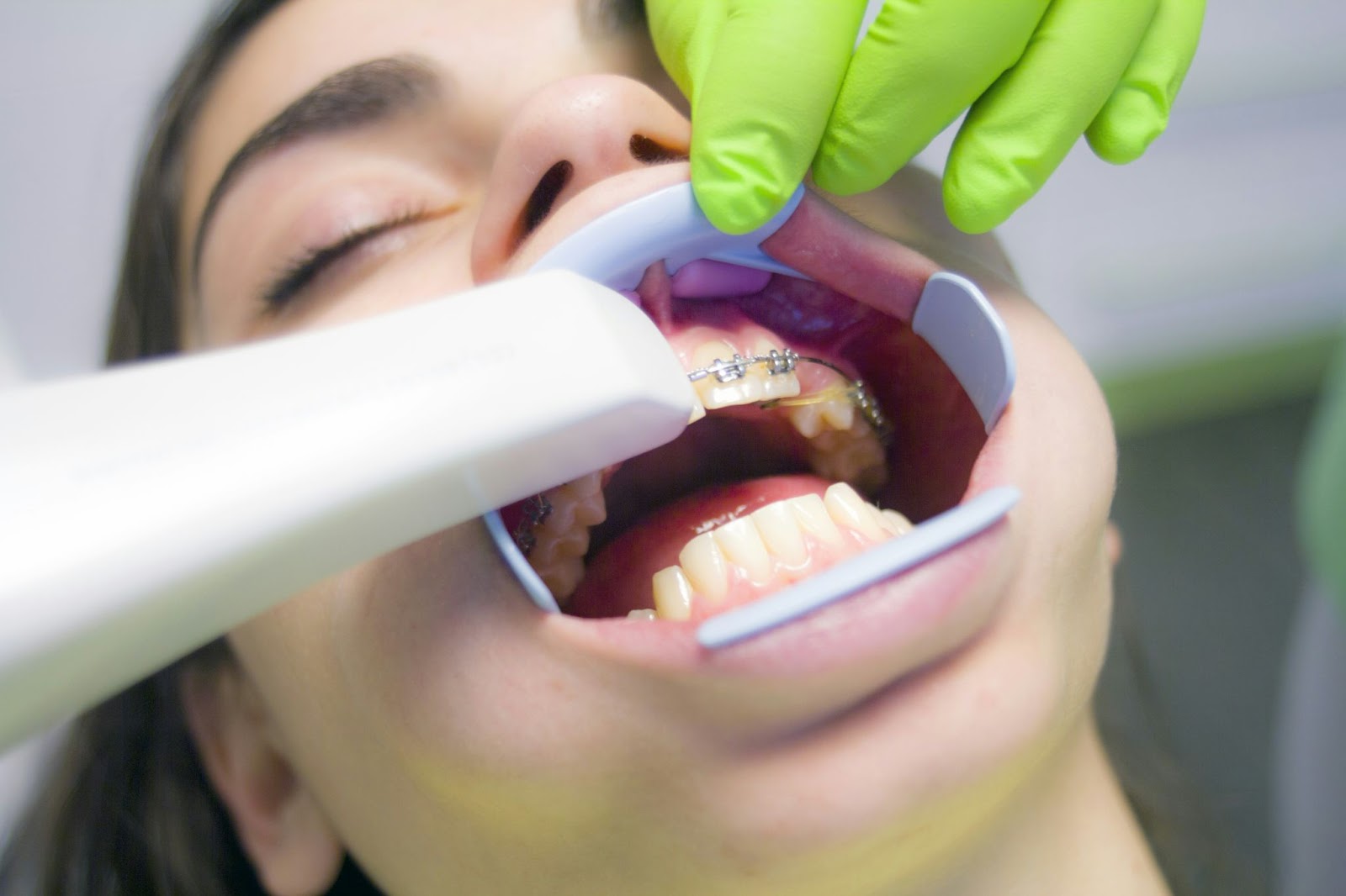 Teen girl having a routine dental cleaning with braces on.