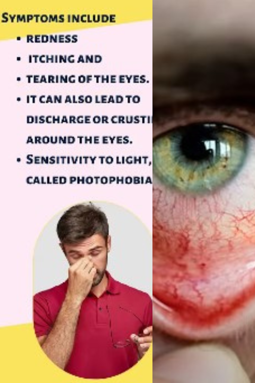 hyperthyroidism symptoms of thyroid issues