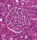 An example of a glomerulus in a WSI
