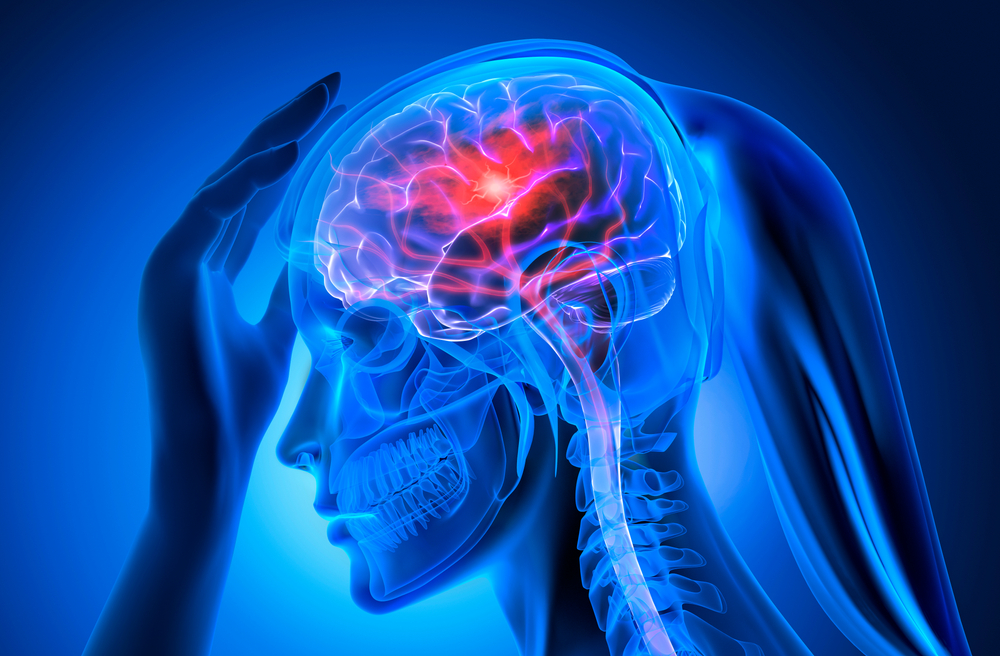 X-ray view of a woman's head showing brain and bones. 