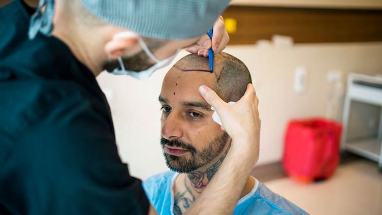 Hair Transplant Cost in India
