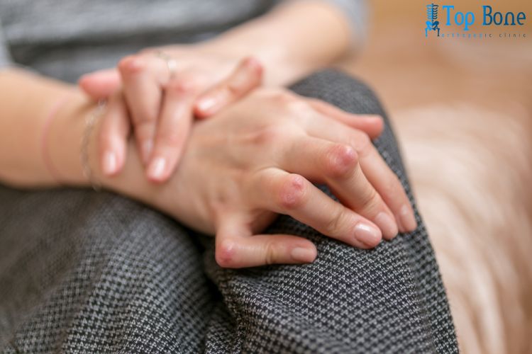 أعراض الروماتويد عند النساء