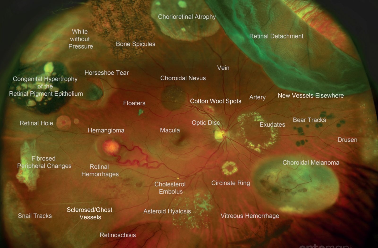 an image of an eye showing possible diseases and issues