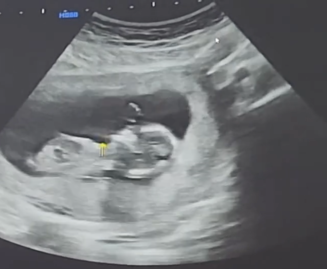 A picture of Singer-songwriter Lee Jinah baby in her womb