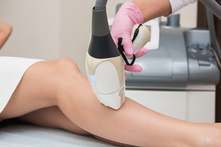 in this image the girl is taking laser hair removal treatment on leg at Ageology skin clinic by https://ageology.in/