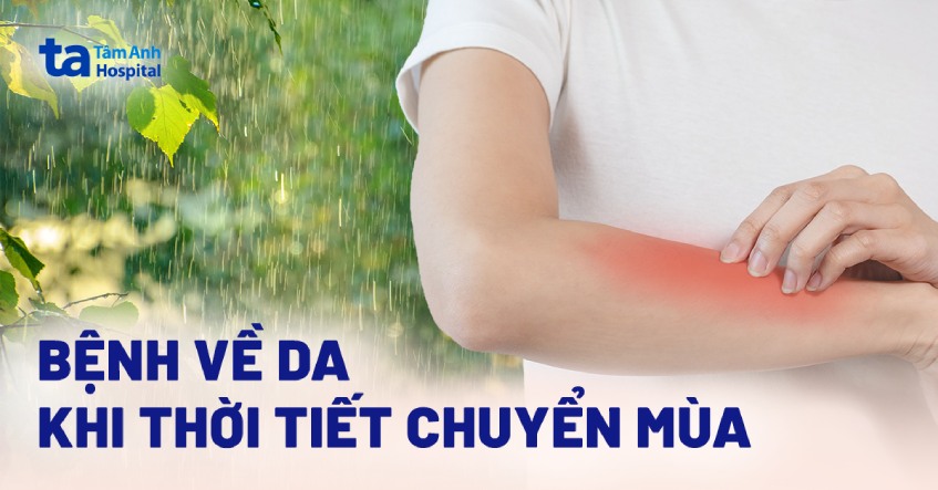 Sức khỏe, đời sống:  Cùng mỹ phẩm TH Natural tìm hiểu4 BỆNH VỀ DA KHI THỜI TIẾT  AD_4nXcPX0kC_P-q79wq91cg9dB3cMTMpOXh6clZwRWaMy-KQHzcTRXP_CXOHShgW_O-jprTp-PElIdBq79_eCDZc7CPWV68innnofclF3zShgppP-rNtH6KPLP3IQG_fcnBPPj40AYgrgHfNKAz8w2VopKXvEA?key=-8hukm0ry6Yc2bAZ31c0Kw