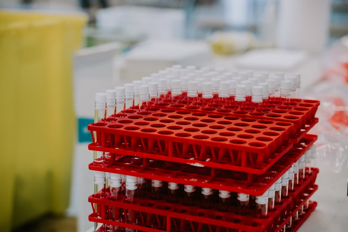 stacked-red-racks-filled-with-laboratory-test-tubes-capped-with-white-lids-on-lab-bench-the-vesugen-biohacker-stack-is-dominating-the-underground-heres-why-tony-huge