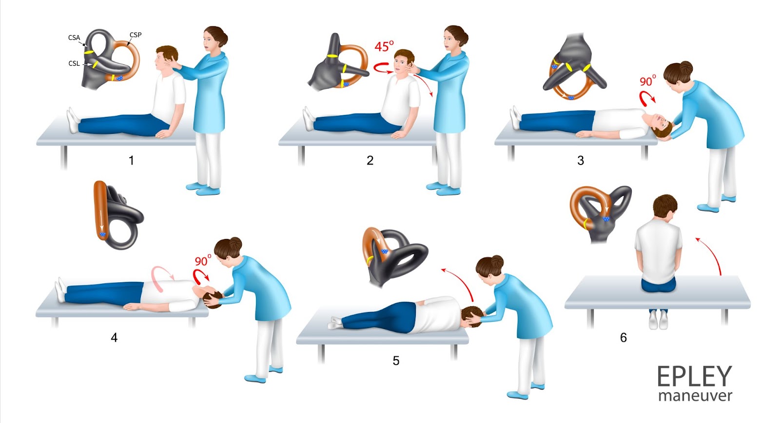 concussion physiotherapy 